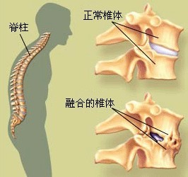 四联通痹疗法相关图片