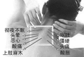 颈椎病危害图片